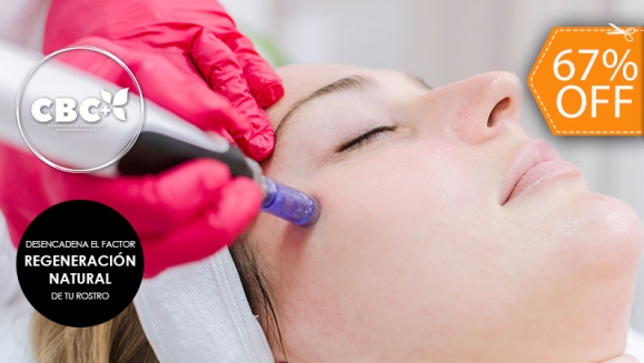 [Image: ¡Paga $30 en Lugar de $90 por Rejuvenecimiento Facial que Incluye: 1 Sesión de Plasma Rico en Plaquetas con Microneedling + 1 Limpieza Facial Profunda + 1 Mascarilla de Ácido Hialurónico + 1 Sellador de Ozono + 2 Mascarillas Vampiro!m]