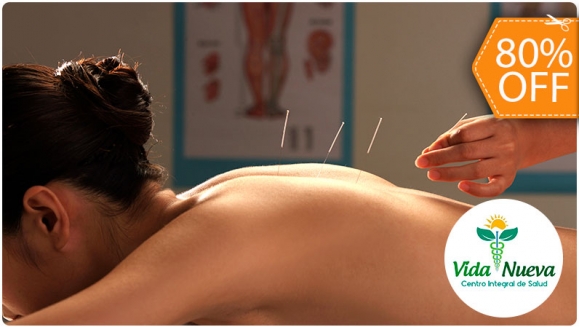 Image of 1 Sesión de Acupuntura + 1 Masaje Relajante