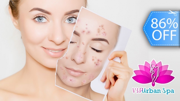 Image of Facial Antiacné, Antimanchas y de Rejuvenecimiento con Microdermoabrasión, Peeling Ultrasónico y Máscara LED