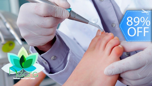 Image of Sesión Láser para Eliminar Hongos en 10 Uñas y Más