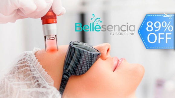 Image of Láser o Peeling Facial para Antiacné, Antimanchas o Antiarrugas