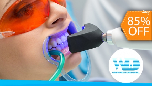 Image of Blanqueamiento Dental Químico con Luz LED + Limpieza Dental Profunda