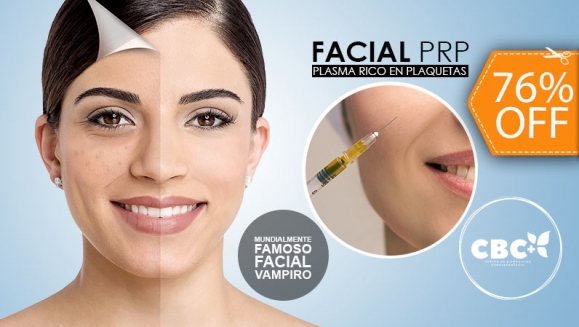 [Image: ¡Paga $60 en Lugar de $250 por Rejuvenecimiento Facial que Incluye: 1 Sesión de Plasma Rico en Plaquetas (PRP) Inyectado + 1 Sesión de PRP con Microneedling + 1 Limpieza Facial + 1 Mascarilla de Carbono + 1 Sellador de Ozono + 2 Mascarillas Vampiro!m]