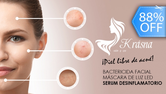 Image of 2 Sesiones de Facial Antiacné y Más.