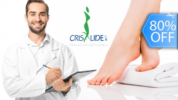 Image of Sesión Láser para Eliminar Hongos de las Uñas 