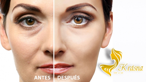 [Image: ¡Paga Q99 en vez de Q750 por Novedoso Facial de Rejuvenecimiento “Hollywood Peel” con: Radiofrecuencia Tripolar + Aplicación de Láser + Mascarilla de Carbón Activado y Caviar Negro + Extracción de Puntos + Exfoliación + Velo de Colágeno y Más!m]
