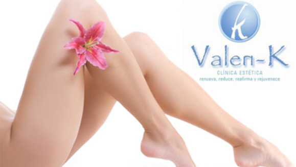 [Image: ¡Paga Q720 en lugar de Q2,400 por 8 sesiones de depilación permanente con Luz Pulsada Intensa (IPL) en ambas piernas (desde las rodillas hasta los tobillos) en Valen-k!m]