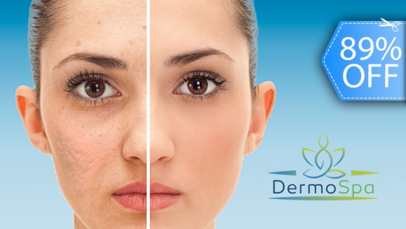 Image of Facial Antiacné, Antimanchas y Anti Aging: Máscara Led, Microdermoabrasión y Más.