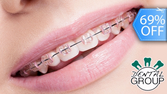 [Image: ¡Paga Q1,400 en lugar de Q4,500 por Colocación de Mini-Brackets INVISIBLES (Superiores e Inferiores) + Evaluación y Diagnóstico Clínico + Profilaxis Dental + Fotografías y Modelo de Estudio!m]