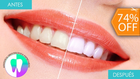 [Image: ¡Paga $50 en Lugar de $195 por Blanqueamiento Dental Químico con Luz LED + Limpieza Profunda con Ultrasonido (Destartraje) + Consulta Odontológica!m]