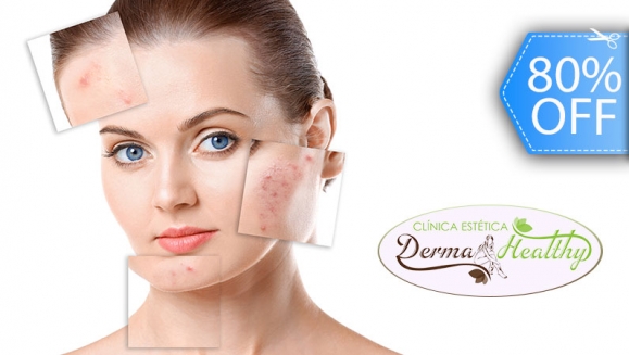 [Image: ¡Paga Q149 en lugar de Q750 por 2 Sesiones Faciales para Eliminar Acné con: 1 Limpieza Clínica Profunda + 1 Extracción de Impurezas + 2 Fototerapias LED + 2 Electroporaciones con Carbón Activado + 2 Altafrecuencias + 2 Hidrataciones y Más!m]
