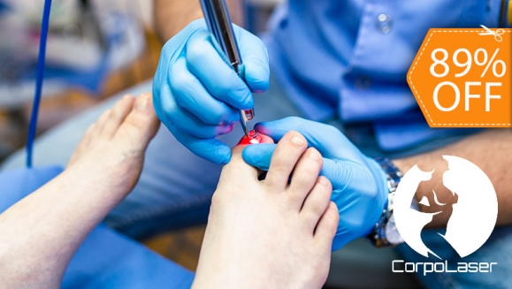 [Image: ¡Paga $35 en lugar de $325 por 1 Sesión de Láser Dermatológico para Eliminar Hongos en hasta 5 Uñas!m]
