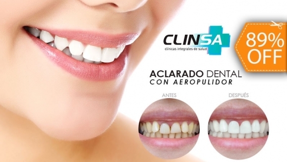 [Image: ¡Paga $20 en Lugar de $190 por Aclarado Dental con Aeropulidor + Limpieza Dental con Ultrasonido + 1 Relleno Estético de Resina + Aplicación de Flúor y Diagnóstico con Cámara Intraoral + Consulta para 1 Acompañante!m]