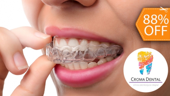 [Image: ¡Paga $15 en Lugar de $125 por Férula Dental + Evaluación Dental!m]