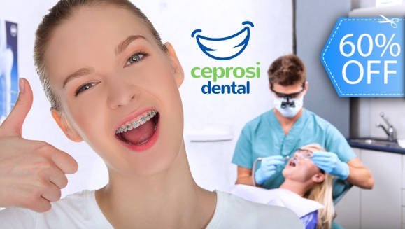 [Image: ¡Paga Q599 en lugar de Q1,500 por Colocación de Mini-Brackets Metálicos (Inferior y Superior) + Set de Radiografías Intraorales + Modelos de Estudio + Limpieza Dental + Kit de Limpieza!m]