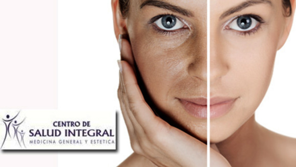 [Image: ¡Paga $17 en lugar de $60 por una sesión de microdermoabrasión de cristales de aluminio que incluye: limpieza profunda, extracción de puntos, alta frecuencia antiacné/antiaging, mascarilla oxyvital y más en Centro de Salud Integral!m]