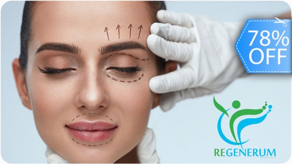 [Image: ¡Paga Q999 en lugar de Q4,500 por Lifting de Párpados (Superiores o Inferiores) o de Labio Superior (Código de Barras) con Plasma Láser!m]