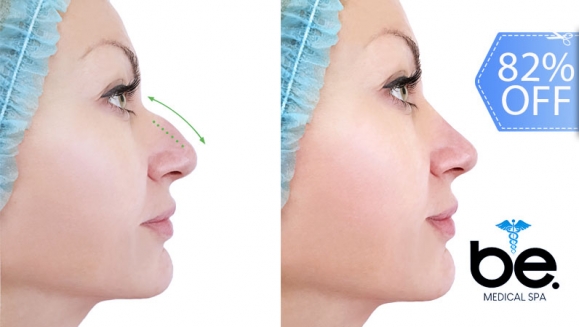 [Image: ¡Paga Q1,899 en lugar de Q10,500 por Rinomodelación o Rejuvenecimiento Facial con Hilos Tensores + Aplicación de Ácido Hialurónico o Plasma Gel + 1 Limpieza Facial Profunda + Microdermoabrasión!m]