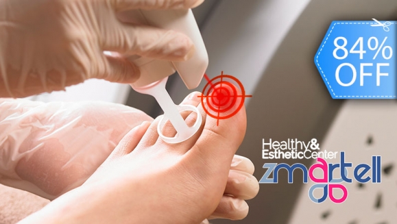 [Image: ¡Paga Q99 en lugar de Q600 por 1 Sesión Láser para Eliminar Hongos en hasta 10 Uñas de Manos o Pies + Diagnóstico Profesional + Aplicación de Crema Antimicótica!m]