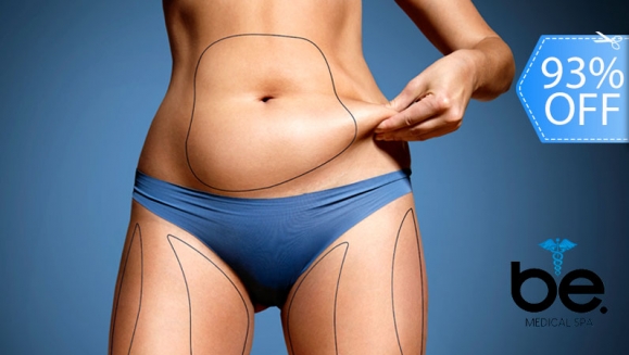 [Image: ¡Ya llegó el sustituto de la cirugía plástica! ¡Paga Q1,200 en lugar de Q18,000 por Tratamiento Intensivo y Exclusivo de 3 Sesiones para Reducción de Medidas con Lipólisis, Tratamiento Ambulatorio Lipoenzimas de Uso Médico + 2 Hilos!m]