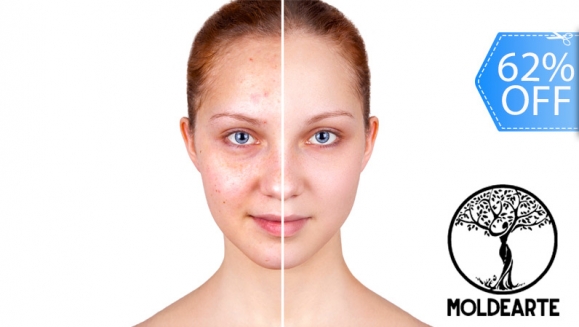 [Image: ¡Paga Q249 en lugar de Q650 por Tratamiento para Reducir Las Cicatrices del Acné que Incluye: Plasma Rico en Plaquetas + Fototerapia con Máscara LED + Altafrecuencia + Mascarilla Neutralizadora + Limpieza Facial!m]