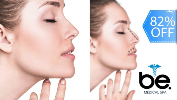 [Image: ¡Paga Q1,899 en lugar de Q10,500 por Rinomodelación o Rejuvenecimiento Facial con Hilos Tensores + Aplicación de Ácido Hialurónico o Plasma Gel + 1 Limpieza Facial Profunda + Microdermoabrasión + Evaluación!m]