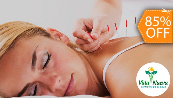 [Image: ¡Paga $12 en Lugar de $80 por 1 Sesión de Acupuntura + 1 Masaje Relajante + ajuste quiropráctico y Evaluación con Iridología (Estudio del Iris del Ojo)!m]