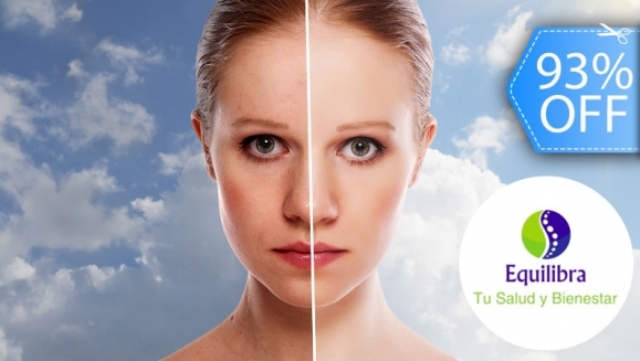 [Image: ¡Paga Q199 en vez de Q2,800 por Rejuvenecimiento y Relleno Facial para Eliminar Arrugas, Líneas de Expresión y Cicatrices que Incluye: Rellenos con Células Madre, Aplicación de Enzimas Plaquetarias, Estiramiento, Tensado Facial y Más!m]