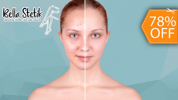 [Image: ¡Paga $20 en Lugar de $90 por 2 Sesiones Faciales que Incluyen: 1 Microdermoabrasión + 1 Peeling Mandélico + 1 Extracción de Puntos Negros + 1 Exfoliación + 1 Mascarilla de Carbón + 2 Serum Hidratantes y Más!m]