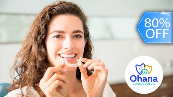 [Image: ¡Paga Q110 en Lugar de Q550 por Guarda Oclusal hecho a  medida + Consulta y Evaluación con Cámara Intraoral!m]