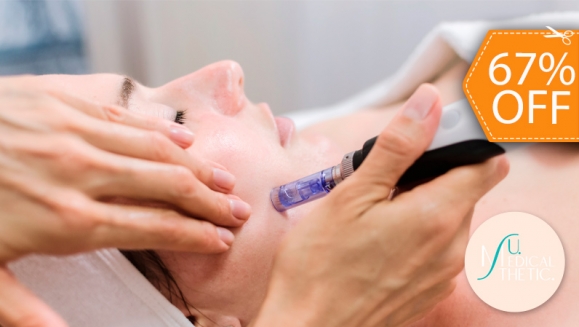 [Image: ¡Paga $30 en Lugar de $90 por Rejuvenecimiento Facial que Incluye: 1 Sesión de Plasma Rico en Plaquetas con Microneedling + 1 Limpieza Facial Profunda + 1 Mascarilla de Ácido Hialurónico + 1 Sellador de Ozono + 2 Mascarillas Vampiro!m]