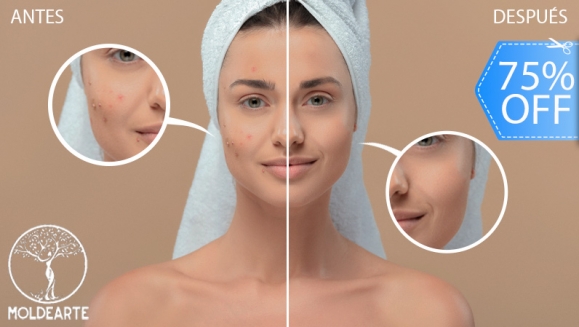 [Image: ¡Paga Q99 en Lugar de Q400 por Facial Antiacné y Antimanchas que Incluye: 1 Microdermoabrasión + 1 Radiofrecuencia 1 Limpieza Facial + 1 Exfoliación + 1 Vapor de Ozono + 1 Extracción de Puntos Negros + 1 Velo de Colágeno y Más!m]