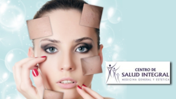 [Image: ¡Paga $35 en lugar de $180 por 4 sesiones de peeling químico facial que incluye: 4 aplicaciones de ácido glicólico + 4 altafrecuencias + hidratación y protección solar + mascarilla anti-envejecimiento o anti-acné en El Centro de Salud Integral!m]