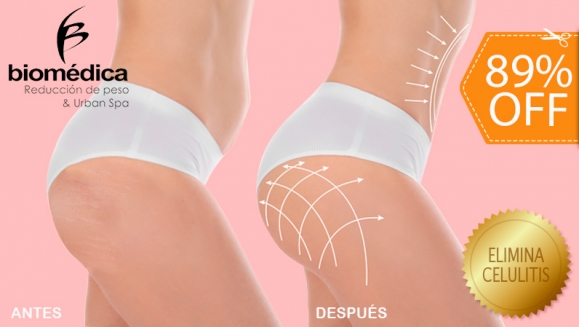 [Image: ¡Paga $22 en lugar de $200 por Tratamiento "GLUPACK 4 en 1": Levanta los Glúteos, Reduce y Reafirma Caderas y Piernas y Elimina La Celulitis con: 5 Nanofrecuencias Brasileñas + 3 Maderoterapias + 3 Lumicell Infrarrojo + 3 Térmicos Abdominales y Más!m]