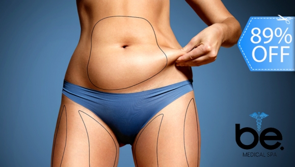 [Imagen:¡Paga Q1,999 en lugar de Q18,000 por Tratamiento Intensivo para Reducción de Medidas con Exilis Elite + 5 Lipólisis + Metabolización + Radiofrecuencia Trio X7 + Cavitación 40K + Mesoterapia PBS + Masaje Drenante + Masaje Reductor y Más!]