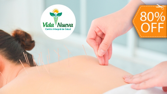 [Image: ¡Paga $9 en Lugar de $45 por 1 Sesión de Acupuntura + 1 Sesión de Moxibustión (Terapia China de Calor Sanador) + Evaluación con Iridología (Estudio del Iris del Ojo)!m]