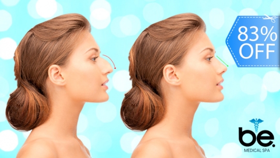 [Image: ¡Paga Q1,899 en Lugar de Q11,000 por Rinomodelación o Rejuvenecimiento Facial con Hilos Tensores + PRP o Aplicación de Ácido Hialurónico + 1 Limpieza Facial Profunda + Microdermoabrasión + 1 Sesión de Lipólisis QUEMA GRASA CORPORAL!m]