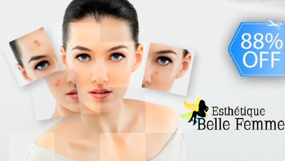 [Image: ¡Paga Q99 en lugar de Q800 por Microdermoabrasión o Peeling Personalizado + Facial de Limpieza Profunda con Exfoliación + Alta Frecuencia + Energía Galvánica + Hidratación + Extracción de Puntos Negros + Vaporización  y Aromaterapia!m]