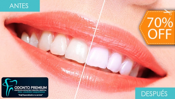 [Image: ¡Paga $59 en Lugar de $195 por Blanqueamiento Dental Químico con Luz LED + Limpieza Manual + Profilaxis (Pulido Dental) + Consulta Odontológica!m]