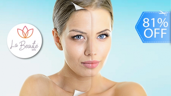 [Image: ¡Paga Q249 en Lugar de Q1,300 por 3 Sesiones de Rejuvenecimiento Facial que Incluye: 3 Láser IPL + 3 Limpiezas Faciales + 3 Aplicaciones de Serum de Retinol + 3 Aplicaciones de Vitamina C + 3 Aplicaciones de Filtro Solar!m]