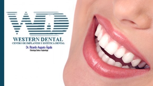 [Image: ¡Paga $32 en lugar de $150 por Diagnóstico Buco-Dental + Limpieza con Ultrasonido + Aplicación de Flúor + 1 Radiografía + 2 Rellenos Estéticos de Resina Blanca en Western Dental! Obtén 20% de descuento en tratamientos adicionalesm]