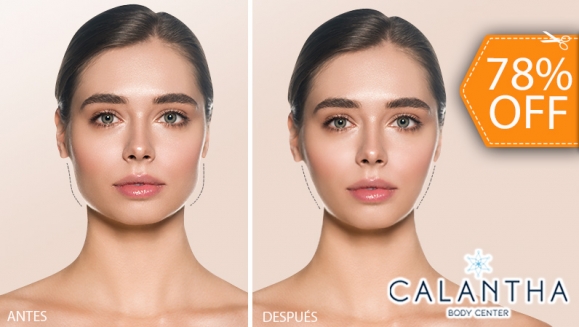 [Image: ¡Paga $99 en Lugar de $450 por 3 Sesiones de Moldeo Facial con Efecto Bichectomía con: 3 Infiltraciones Múltiples con Cóctel de Enzimas + 3 Radiofrecuencias + 3 Masajes Linfáticos + Evaluación Médica + Membresía Anual!m]