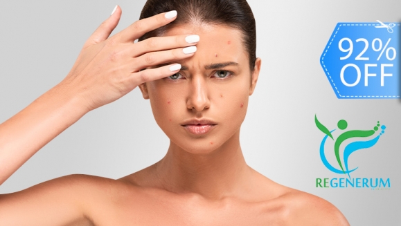 [Image: ¡Paga Q69 en Lugar de Q850 por Facial Antiacné o Antimanchas que Incluye: Sesión Láser o Peeling + Limpieza Facial + Extracción de Puntos + Mascarilla Personalizada + Hidratación + Protección Solar!m]