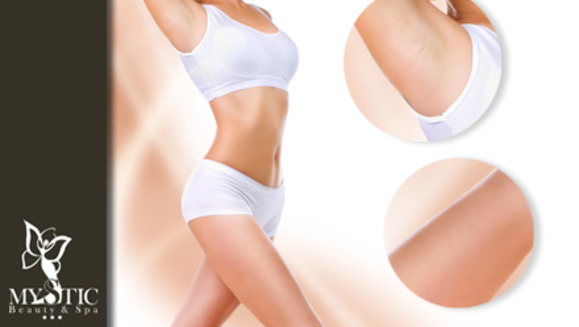 [Image: ¡Paga Q299 en lugar de Q900 por 12 sesiones de depilación IPL en media pierna y axilas en Mystic Beauty &amp; Spa!m]