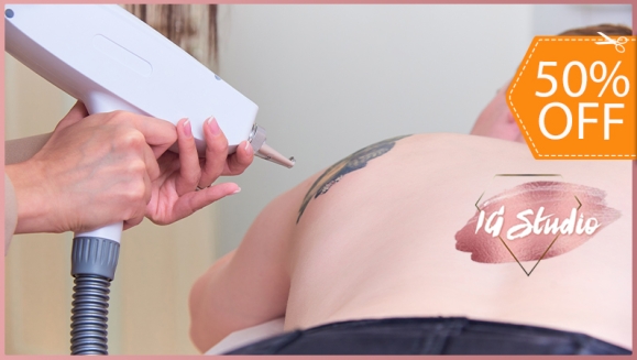 [Image: ¡Paga $125 en Lugar de $250 por 2 Sesiones Láser para Eliminar Tatuaje Color Negro de 10 cm x 10 cm!m]