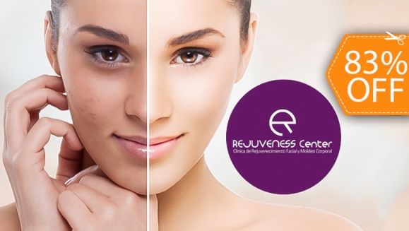 [Image: ¡Paga $30 en vez de $180 por 3 Sesiones Faciales para Tratar Manchas Solares, Acné o Líneas de Expresión con 3 Peelings de Ácido Glicólico- Láctico + 3 Mascarillas de Colágeno + Análisis Facial y Más!m]