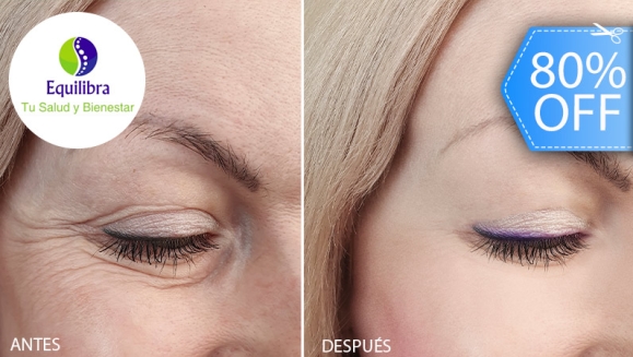 [Image: ¡Paga Q499 en Vez de Q2,500 Blefaroplastia Sin Cirugía con Tecnología Plasma PlexR para Eliminar Párpados Caídos, Arrugas, Manchas, Lunares y Marcas de Acné + Rejuvenecimiento con Relleno Plasma Gel en Entrecejo, Patas de Gallo o Surco Nasogeniano!m]
