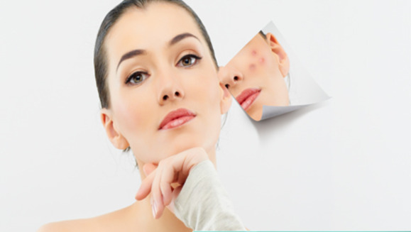 [Image: ¡Paga Q250 en lugar de Q1200 por Paquete de 3 Microdermoabrasiones con punta de diamante  que incluyen limpieza facial, alta frecuencia y velo de colágeno en Clínica Biológica y Estética de Guatemala!m]