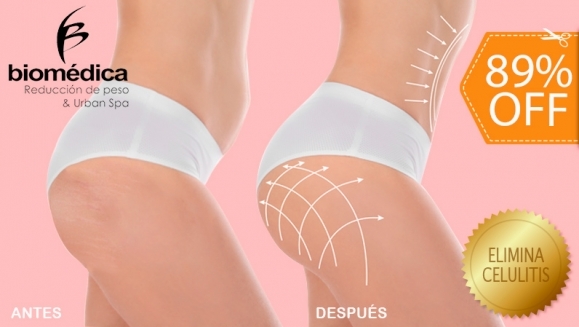 [Image: ¡Paga $22 en vez de $200 por Tratamiento "GLUPACK 4 en 1" + Bono de 2 Limpiezas Faciales: Levanta los Glúteos, Reduce Las Piernas, Moldea Las Caderas y Elimina La Celulitis con: 5 Nanofrecuencias Brasileñas + 3 Maderoterapias + 3 Lumicell y Más!m]