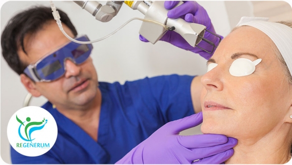 [Image: ¡Paga Q395 en lugar de Q1,500 por Rejuvenecimiento Facial con 1 Sesión de Láser CO2 Fraccionado + 1 Limpieza Facial + 1 Sesión de Plasma Rico en Plaquetas!m]